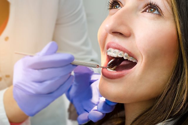 Nên ăn gì khi niềng răng để đảm bảo dinh dưỡng?